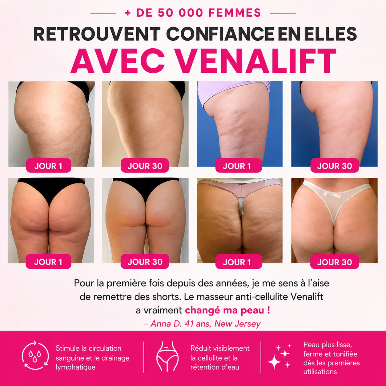 VenaLift™ — Masseur Anti-Cellulite 4-en -1