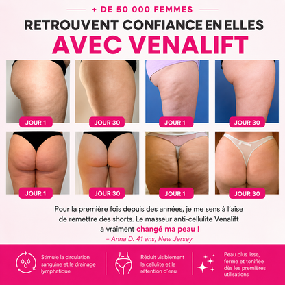 VenaLift™ — Masseur Anti-Cellulite 4-en -1